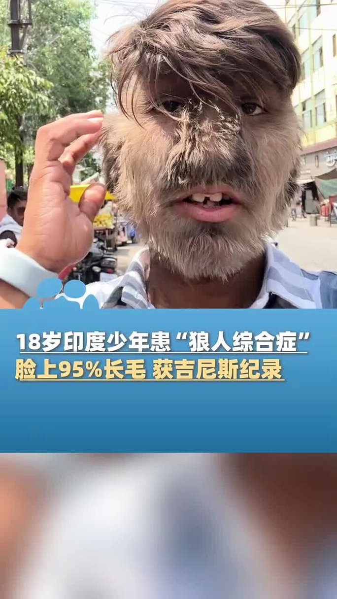 女性私处分泌物发黄粘稠的相关介绍